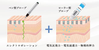 エレクトロポレーション(メソナJ)とは