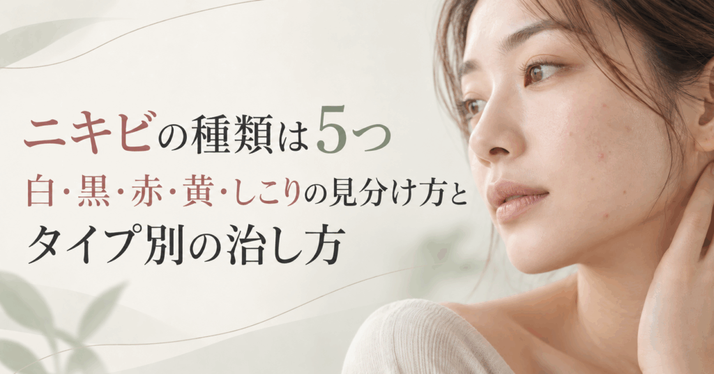 ニキビの種類は5つ｜白・黒・赤・黄・しこりの見分け方とタイプ別の治し方｜大阪梅田のM.CLINIC