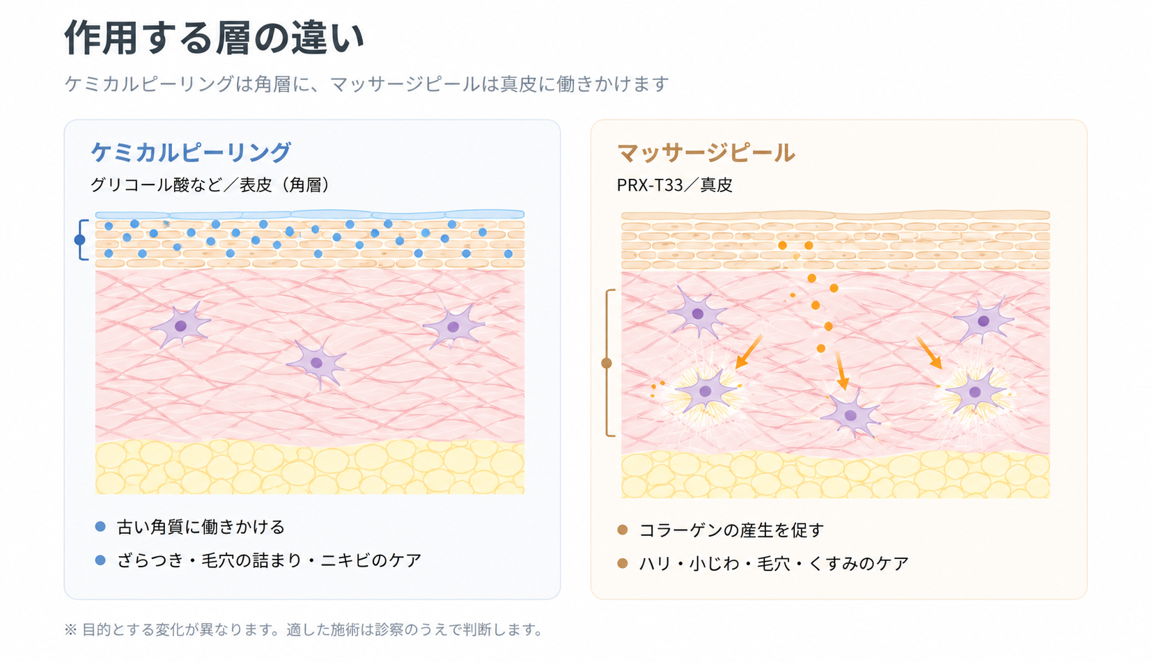 マッサージピールとケミカルピーリングの作用する層の違いを比較した図