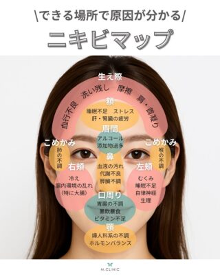 @m.clinic_official

こんにちは💖
今回はニキビのできる場所と原因が
一目でわかるニキビマップをご紹介します🤭💫

ニキビの場所ごとに、原因は少しずつ違います🌱 その“できる位置”が、
あなたの肌や体からのサインかもしれません😌

📍部位別ニキビマップで原因をチェック ✔️生活習慣を見直すヒントに ✔️カウンセリング前の参考にも

保存して、いつでも見返せるようにしておきましょう🩵

#大阪美容皮膚科#梅田美容皮膚科#美容皮膚科#mclinic #ハイドラジェントル#ワキボトックス#ipl#レーザートーニング#レーザータイトニング#ニキビマップ #肌トラブル #スキンケア知識 #保存推奨