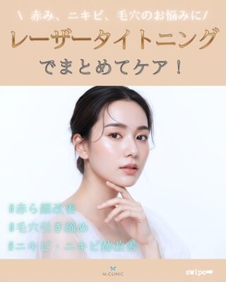 @m.clinic_official 

✨肌悩みをまとめてケアする「レーザータイトニング」✨

レーザーの熱エネルギーをお肌の深部まで届けることで、コラーゲン生成を促進！
肌の内側からハリ・弾力を高め、キメの整ったなめらかな肌へ導きます💎
さらに、赤みの原因となる毛細血管へアプローチすることで赤ら顔・ニキビ跡の赤みを改善😊
ニキビの炎症を抑える効果があり、ニキビのケアにも効果的🌿
毛穴の開きが気になる方にもおすすめで、施術後はキュッと引き締まったような印象へ✨

こんなお悩みにおすすめ👇
✔ 赤ら顔が気になる
✔ 繰り返すニキビを改善したい
✔ ニキビ跡をケアしたい
✔ 毛穴の開き・たるみ毛穴が気になる
✔ 肌のハリや弾力をアップしたい

ダウンタイムが少ないため、美容医療が初めての方にも人気の施術です💐
同じく人気施術のハイドラジェントルとの組み合わせがとってもオススメ❤️

気になる方は大阪梅田の美容皮膚科M.CLINIC(エムクリニック)まで✨✨

ご予約はWEB、LINE、お電話より承っております💕

 #赤ら顔改善 #ニキビ改善 #ニキビ跡改善 #毛穴ケア #大阪美容皮膚科