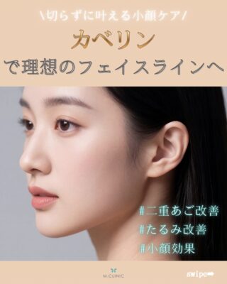 @m.clinic_official 

＼ 切らない小顔ケア✨ ／

「フェイスラインのもたつきが気になる…」
「二重あごをすっきりさせたい」

そんな方におすすめなのが【カベリン】です◎

カベリンは、脂肪へアプローチする脂肪溶解注射💉
気になる部分へピンポイントに注入することで、すっきりとした印象を目指します✨

✔ フェイスラインを整えたい
✔ 二重あごが気になる
✔️ ほうれい線横のたるみが気になる
✔ 部分痩せしたい
✔ ダウンタイム少なめがいい
✔ 切る施術は抵抗がある

そんな方におすすめです☺️

施術時間も短く、美容医療初心者の方にも人気の施術です◎
気になる方はぜひお気軽にご相談ください🤍

5月はお得なキャンペーンも実施中！
気になる方は今がチャンスです🥰

ご予約は、WEB、LINE、お電話より承っております。
皆様のご来院心よりお待ちしております✨✨

#大阪美容皮膚科 #小顔治療 #カベリン #脂肪溶解注射 #美容医療