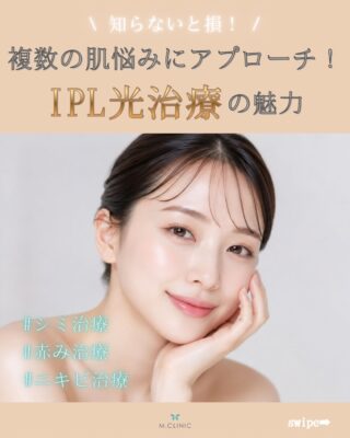 @m.clinic_official

✨ シミ・ニキビ・赤みなど、肌全体のお悩みにアプローチ✨

「最近、肌の調子がなんとなく気になる…」
そんな方におすすめなのが IPL（光治療）です💡

IPLは、さまざまな波長の光を肌に照射することで、
✔ シミ・そばかす
✔ ニキビ・ニキビ跡
✔ 赤ら顔
など、複数のお悩みに幅広くアプローチできる美肌治療です✨

「シミだけでなく、肌全体をきれいに見せたい」という方にも人気の施術です😊

☀️ 夏でも施術は可能！
紫外線対策をしっかり行っていただくことで、季節を問わず施術を受けていただけます。
強い日焼け予定の前後は施術をお控えいただくことがありますので、スタッフまでお気軽にご相談ください。

大阪梅田の美容皮膚科M.CLINIC(エムクリニック)では、肌診断を活用し、丁寧な診察でお一人おひとりに合わせた治療をご提案しています🌿

現在、お得なキャンペーンも実施中✨
詳しくは固定投稿をチェック👀💕

この機会に、美肌ケアを始めてみませんか？

ご予約はWEB、LINE、お電話から😊
皆様のご来院、心よりお待ちしております🩵

#美容皮膚科 #IPL #シミ治療 #ニキビ治療 #美容医療