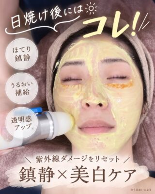 @m.clinic_official 

☀️日焼け後の肌、そのままにしていませんか？

紫外線を浴びた肌は、目には見えなくてもダメージを受けています💦

✔ 赤み・ほてりが気になる
✔ 肌が乾燥してごわつく
✔ なんだかくすんで見える…

そんな日焼け後の肌にはメソナJがおすすめ✨

メソナJは、肌に美容成分を針を使わず角質層まで届ける施術です💎

💧 紫外線によるほてり・赤みをケア
💧 乾燥した肌にうるおいをチャージ
💧 透明感のある肌へ導く
💧 ダウンタイムが少なく、施術後すぐにメイクもOK

投稿では、
🌿 なぜ日焼け後にメソナJがおすすめなのか
🌿 実際の症例
🌿 7・8月限定✨4周年記念キャンペーン
もご紹介しています！

今なら「メソナJ（トータルアンチエイジング）＋高濃度ビタミンC点滴」5回コースが20％OFF🎉
夏の紫外線ダメージは、早めのケアがおすすめです🌻
気になる方は大阪梅田の美容皮膚科エムクリニックまで、お気軽にご相談ください😊

💡 ご予約はWEB・お電話・LINEから✨

皆様のご来院心よりお待ちしております🩵

#メソナj #メソナj大阪 #美容皮膚科 #紫外線対策 #美白ケア