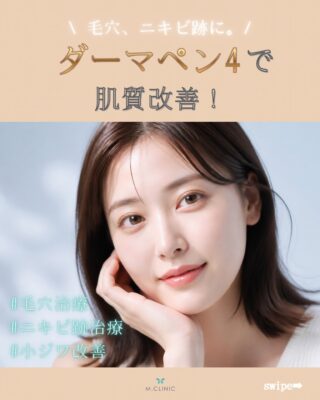 @m.clinic_official
✨毛穴・ニキビ跡・肌の凹凸が気になる方へ✨

「肌質を整えたい」
「毛穴を目立ちにくくしたい」
「ニキビ跡の凹凸が気になる」

そんなお悩みにおすすめなのが、ダーマペン4です🩷

ダーマペン4は、極細針で肌に微細な穴を開け、肌本来の再生力を引き出す肌質改善治療。
針の深さを調整しながら、毛穴やニキビ跡、肌の凹凸など、お一人ひとりの肌悩みに合わせて治療を行います✨

【主な効果】
・毛穴の改善
・ニキビ跡・肌の凹凸改善
・肌のハリ・弾力アップ
・小じわの改善
・キメを整える
・肌質改善

さらに、肌悩みに合わせて薬剤を組み合わせることで、目的に合わせた治療も可能です💎

「自分の肌にはどんな治療が合う？」
そんな方も、まずはお気軽にご相談ください☺️

大阪梅田の美容皮膚科 M.CLINIC(エムクリニック)では、肌診断を用いてお一人おひとりに合わせた治療をご提案しております✨

ご予約は、WEB、LINE、お電話から承っております🤍
皆様のご来院心よりお待ちしております🥰

#ダーマペン4 #毛穴治療 #ニキビ跡治療 #大阪美容皮膚科 #梅田美容皮膚科